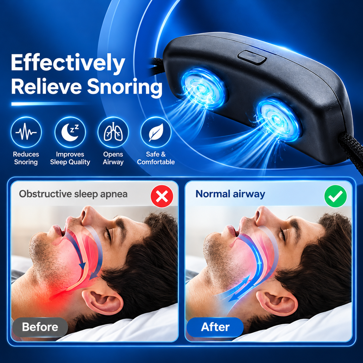 Prime Luxe™ SnoreEase Sleep Device