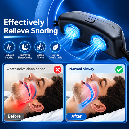 Prime Luxe™ SnoreEase Sleep Device